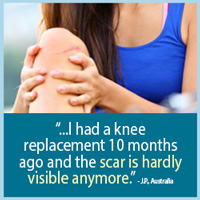 I had a knee replacement 10 months ago and the scar is hardly visible anymore. - J.P., Australia