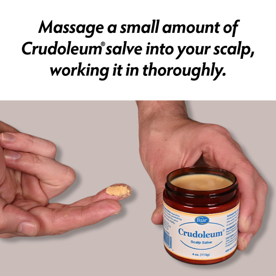 Baar Products, Inc.: Crudoleum Scalp Salve