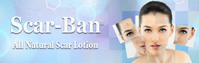 Scar-Ban: All Natural Scar Lotion