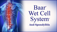 Baar Wet Cell System and Spondylitis