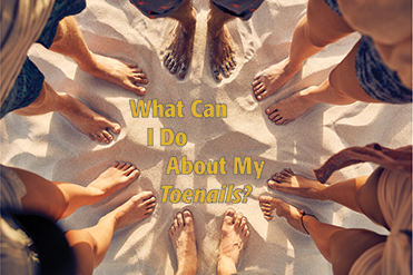 What Can I Do About My Toenails? Blog Post